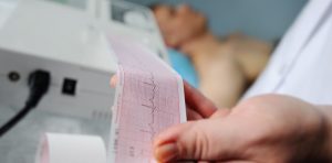 el-electrocardiograma-forma-parte-del___PjT0eQsXk_1256x620__2