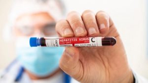 hepatitis-c-768x432