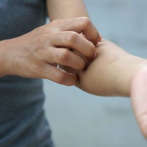 bigstock-woman-scratching-arm-from-itch-370955842_1_621x621